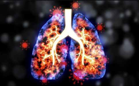 肺癌有胸腔積液、腹水如何解決